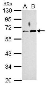RAD9 Antibody in Western Blot (WB)