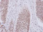XAB2 Polyclonal Antibody