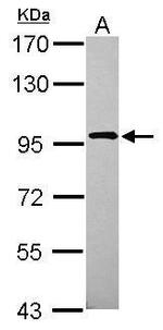 XAB2 Antibody in Western Blot (WB)