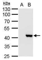 XRCC3 Polyclonal Antibody