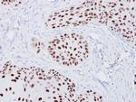 XRCC4 Antibody in Immunohistochemistry (Paraffin) (IHC (P))