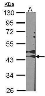 RAD51C Antibody in Western Blot (WB)
