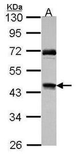 RAD51C Antibody in Western Blot (WB)