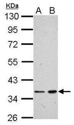 XRCC4 Antibody in Western Blot (WB)