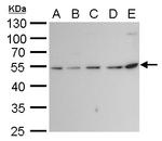 beta Tubulin 2 Antibody in Western Blot (WB)