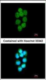 TDP1 Polyclonal Antibody
