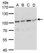 Artemis Antibody in Western Blot (WB)