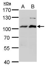 Artemis Antibody in Western Blot (WB)