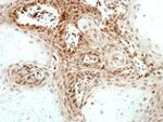 Artemis Antibody in Immunohistochemistry (Paraffin) (IHC (P))