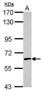 EME1 Polyclonal Antibody