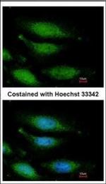 FANCG Polyclonal Antibody