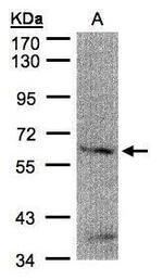 FANCG Antibody in Western Blot (WB)