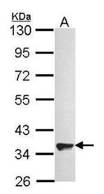 GPR82 Antibody in Western Blot (WB)