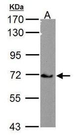 Calcium Channel beta-4 Antibody in Western Blot (WB)