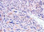CBR1 Polyclonal Antibody