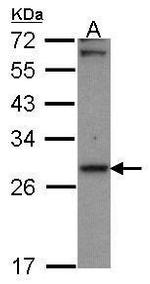 CBR1 Antibody in Western Blot (WB)