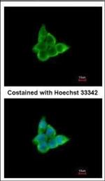 CIS Polyclonal Antibody