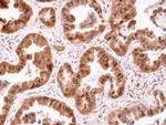 CIS Antibody in Immunohistochemistry (Paraffin) (IHC (P))