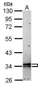 CIS Antibody in Western Blot (WB)