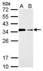 CIS Antibody in Western Blot (WB)