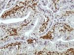DAB2 Antibody in Immunohistochemistry (IHC)