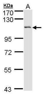DAB2 Antibody in Western Blot (WB)