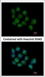 DDX5 Polyclonal Antibody