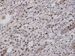 EAR2 Polyclonal Antibody