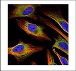 ACSL4 Polyclonal Antibody