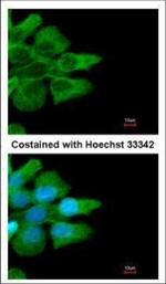 FCGR2B Polyclonal Antibody