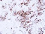 FGFR1 Antibody in Immunohistochemistry (Paraffin) (IHC (P))