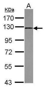 FGFR1 Antibody in Western Blot (WB)