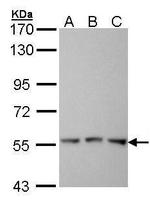 FGR Polyclonal Antibody