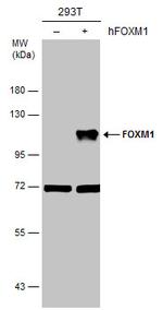FOXM1 Polyclonal Antibody