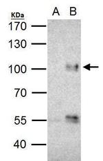 FOXO3A Antibody in Immunoprecipitation (IP)