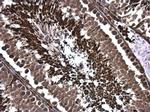 GCN5 Antibody in Immunohistochemistry (Paraffin) (IHC (P))
