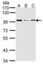 GCN5 Antibody in Western Blot (WB)