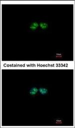 GPS1 Polyclonal Antibody
