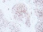 GPS1 Antibody in Immunohistochemistry (Paraffin) (IHC (P))