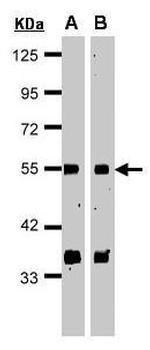 GPS1 Antibody in Western Blot (WB)