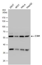 GPS1 Antibody in Western Blot (WB)