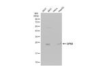 GPX2 Antibody in Western Blot (WB)