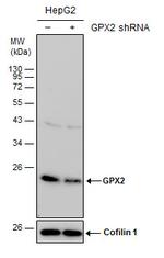 GPX2 Antibody in Western Blot (WB)