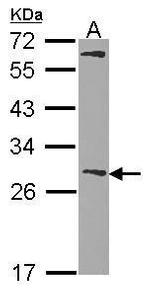 GSTM1 Antibody in Western Blot (WB)