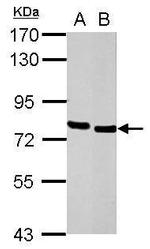 HCLS1 Antibody in Western Blot (WB)
