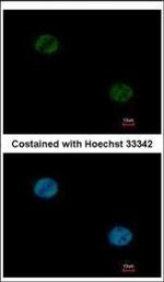 FOXA1 Antibody in Immunocytochemistry (ICC/IF)