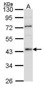 HNF4A Polyclonal Antibody
