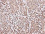 ADAMTS5 Polyclonal Antibody