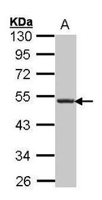 CXCR5 Polyclonal Antibody