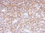 Endothelin B Receptor Antibody in Immunohistochemistry (Paraffin) (IHC (P))